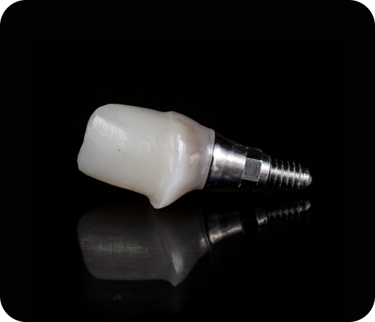 A dental implant
